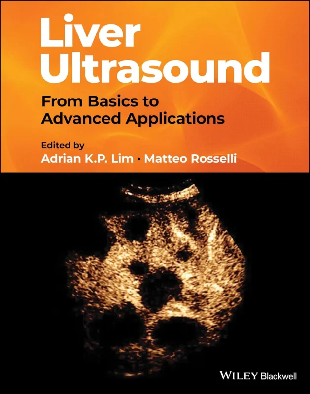 Coperta cărții "Liver Ultrasound: From Basics to Advanced Applications" de autor necunoscut