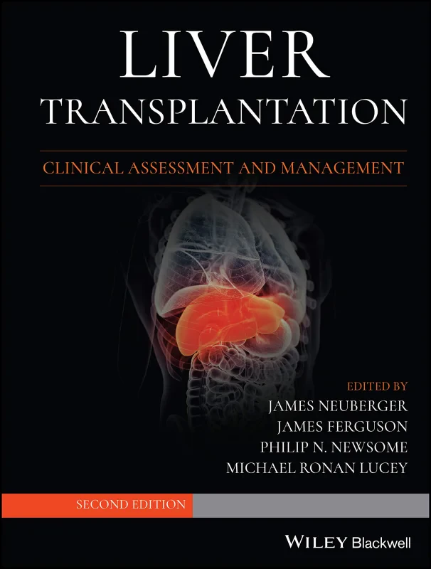 Coperta cărții "Liver Transplantation: Clinical Assessment and Management" de autor necunoscut