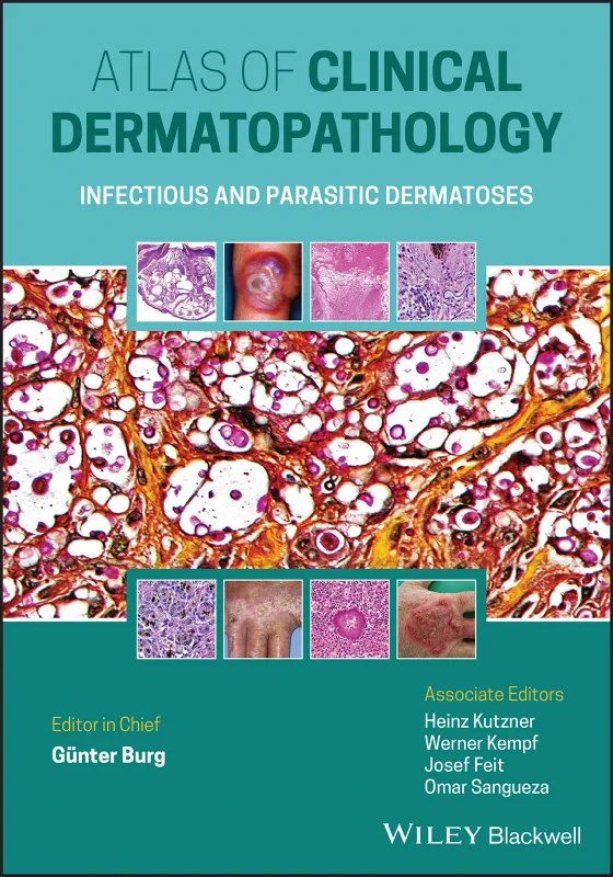 Coperta cărții "Atlas of Clinical Dermatopathology: Infectious and Parasitic Dermatoses" de autor necunoscut