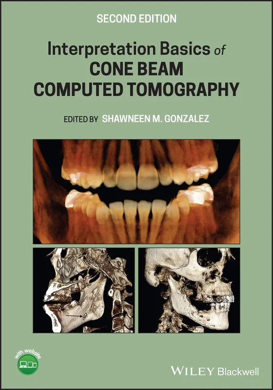 Coperta cărții "Interpretation Basics of Cone Beam Computed Tomography" de autor necunoscut
