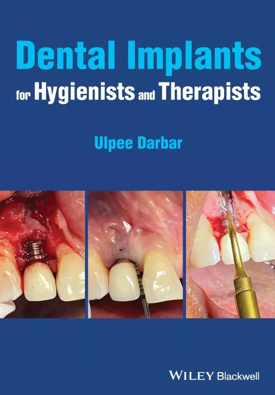 Coperta cărții "Dental Implants for Hygienists and Therapists" de autor necunoscut