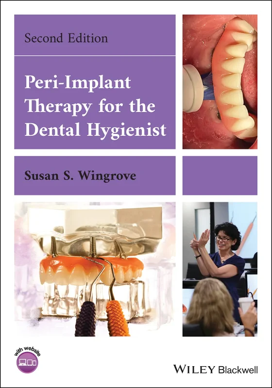 Coperta cărții "Peri&amp;#150;Implant Therapy for the Dental Hygienist" de autor necunoscut
