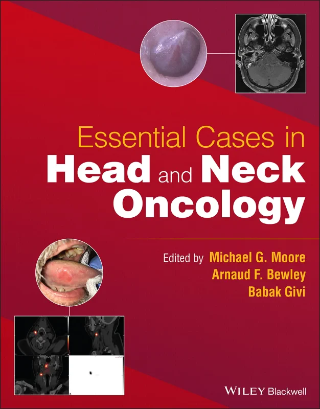 Coperta cărții "Essential Cases in Head and Neck Oncology" de autor necunoscut