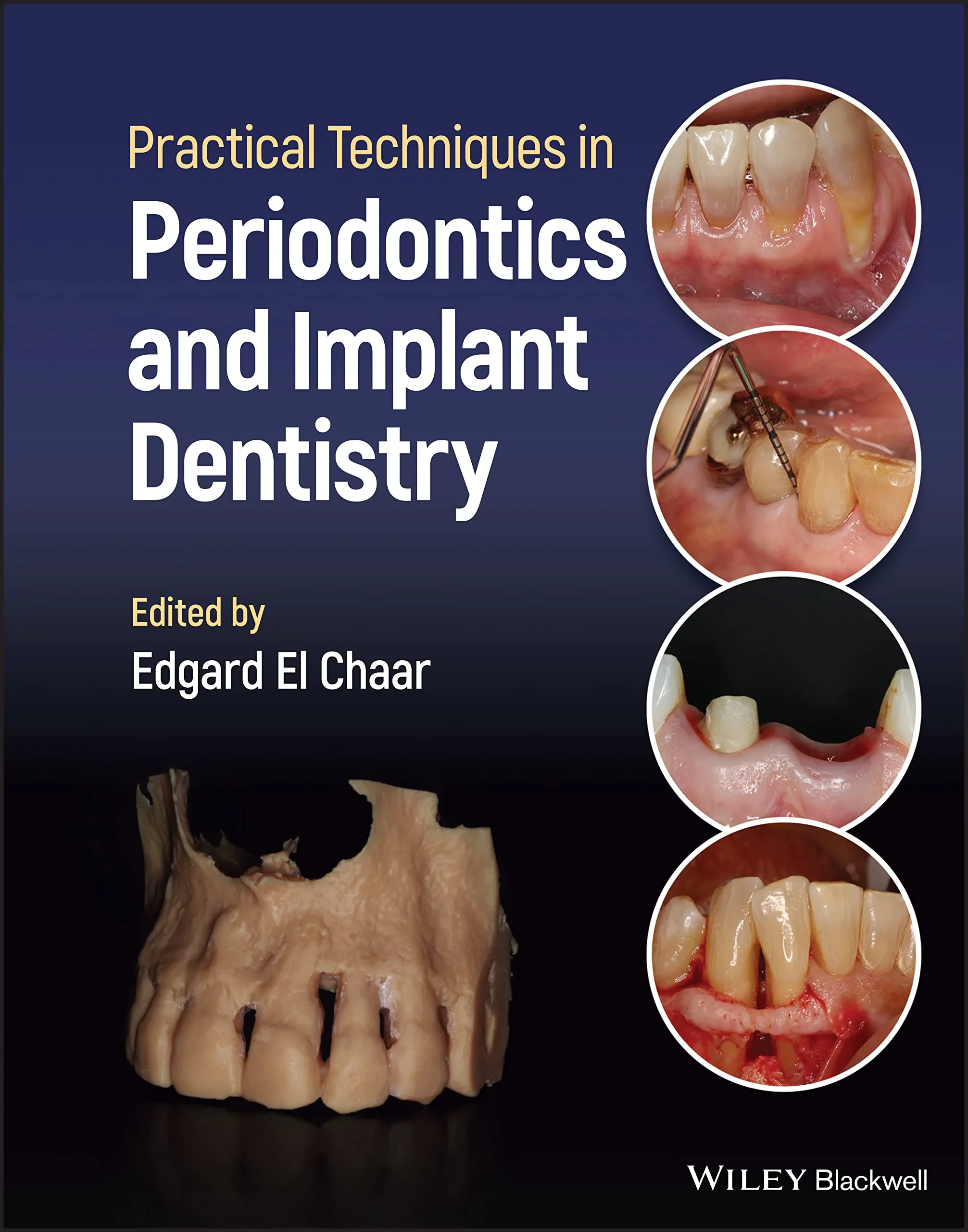 Coperta cărții "Practical Techniques in Periodontics and Implant Dentistry" de autor necunoscut