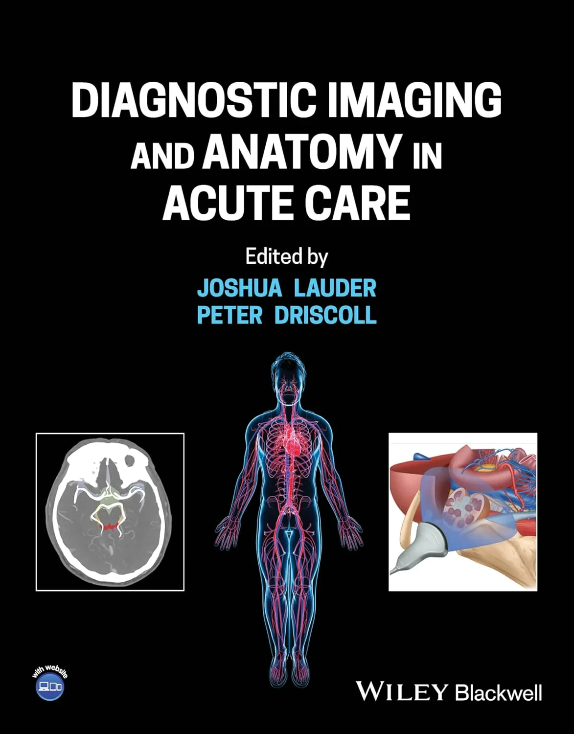 Coperta cărții "Diagnostic Imaging and Anatomy in Acute Care" de autor necunoscut