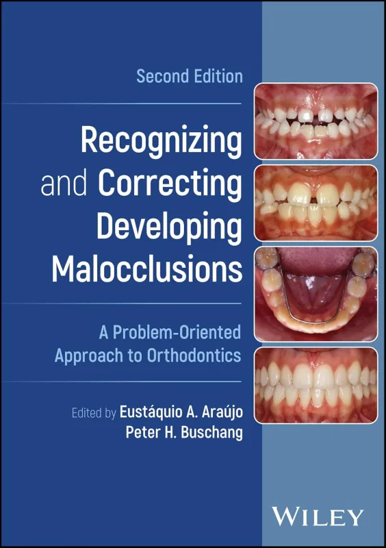 Coperta cărții "Recognizing and Correcting Developing Malocclusions: A Problem-Oriented Approach to Orthodontics" de autor necunoscut