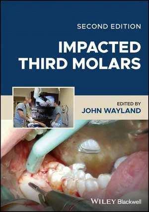 Coperta cărții "Impacted Third Molars, 2nd Edition" de autor necunoscut