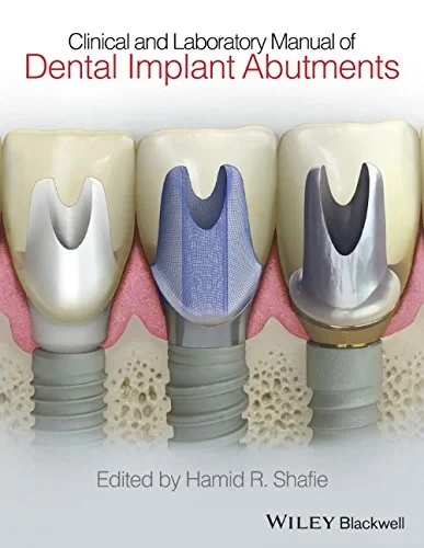 Coperta cărții "Clinical and Laboratory Manual of Dental Implant Abutments" de autor necunoscut