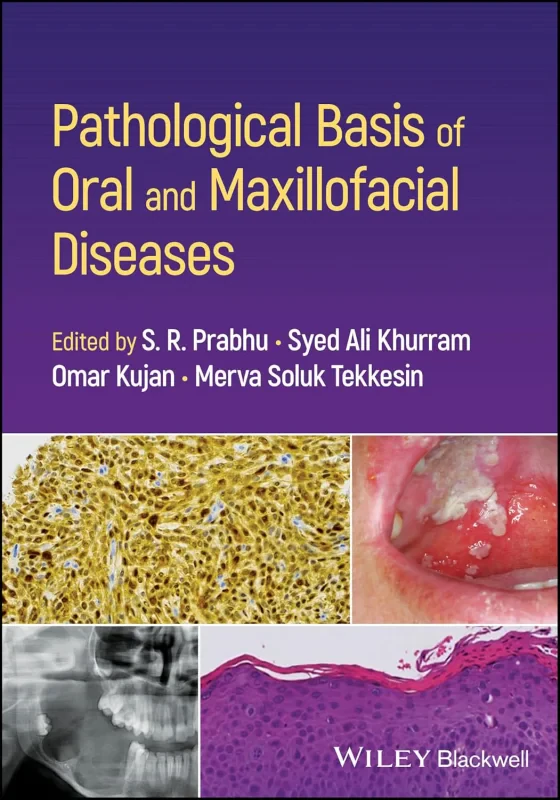 Coperta cărții "Pathological Basis of Oral and Maxillofacial Diseases" de autor necunoscut