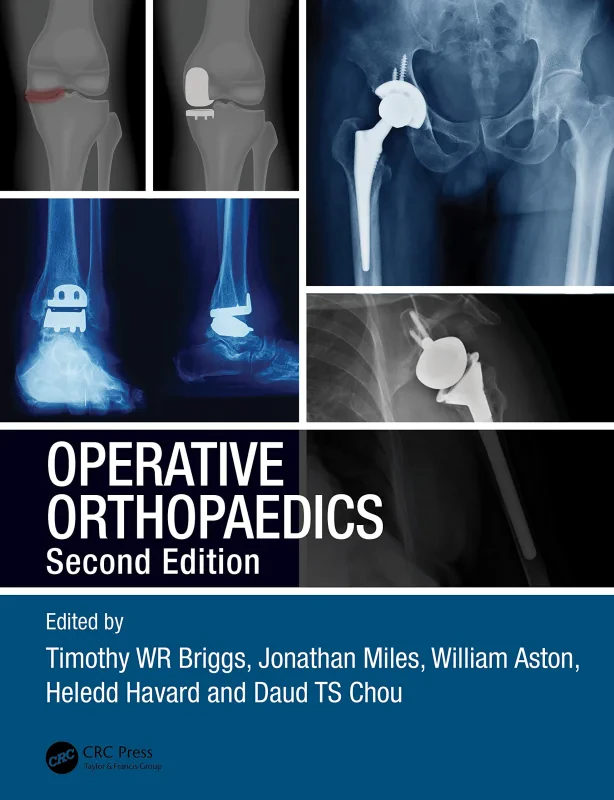 Coperta cărții "Operative Orthopaedics" de autor necunoscut