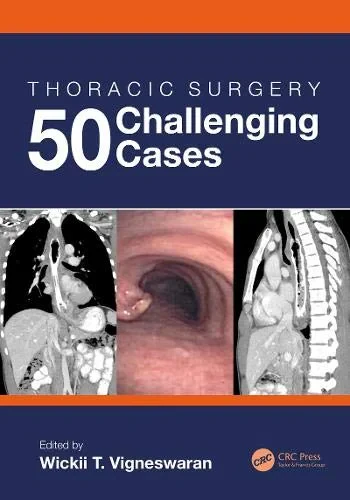 Coperta cărții "Thoracic Surgery: 50 Challenging cases" de autor necunoscut