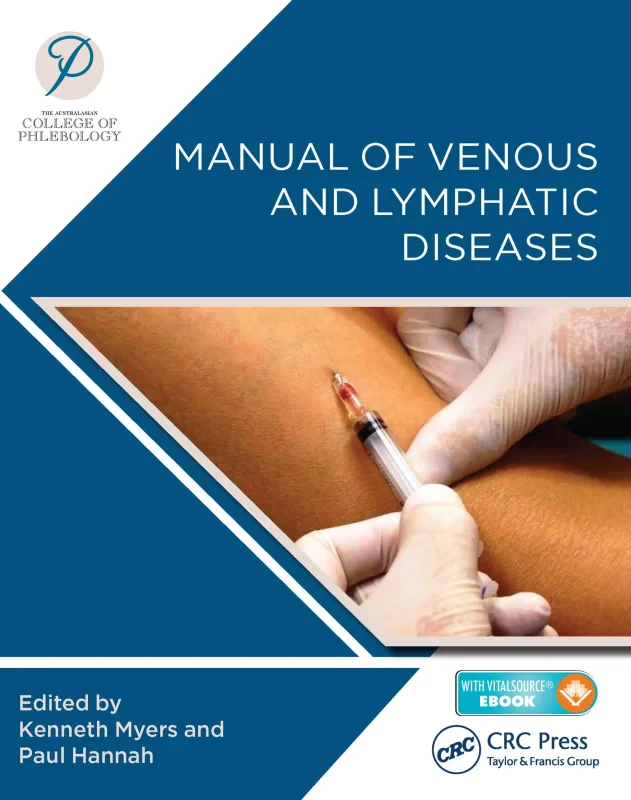 Coperta cărții "Manual of Venous and Lymphatic Diseases" de autor necunoscut