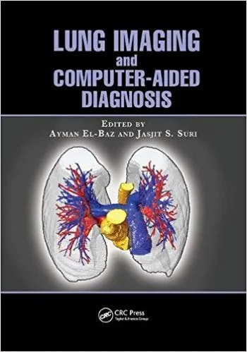 Coperta cărții "Lung Imaging and Computer Aided Diagnosis" de autor necunoscut