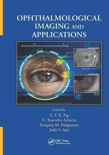Coperta cărții "Ophthalmological Imaging and Applications" de autor necunoscut