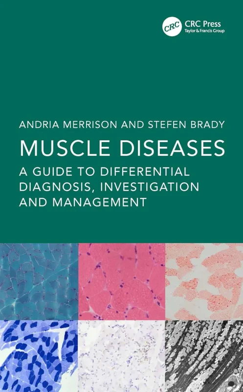Coperta cărții "Muscle Diseases A Guide to Differential Diagnosis, Investigation and Management" de autor necunoscut