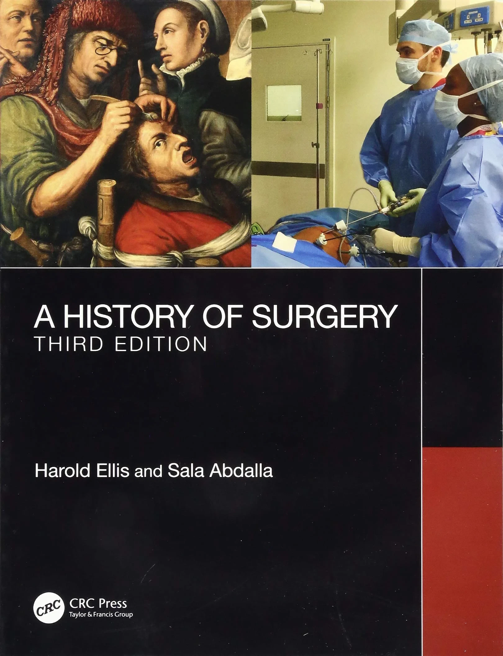 Coperta cărții "A History of Surgery: Third Edition" de autor necunoscut