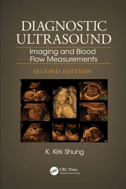 Coperta cărții "Diagnostic Ultrasound: Imaging and Blood Flow Measurements, Second Edition" de autor necunoscut