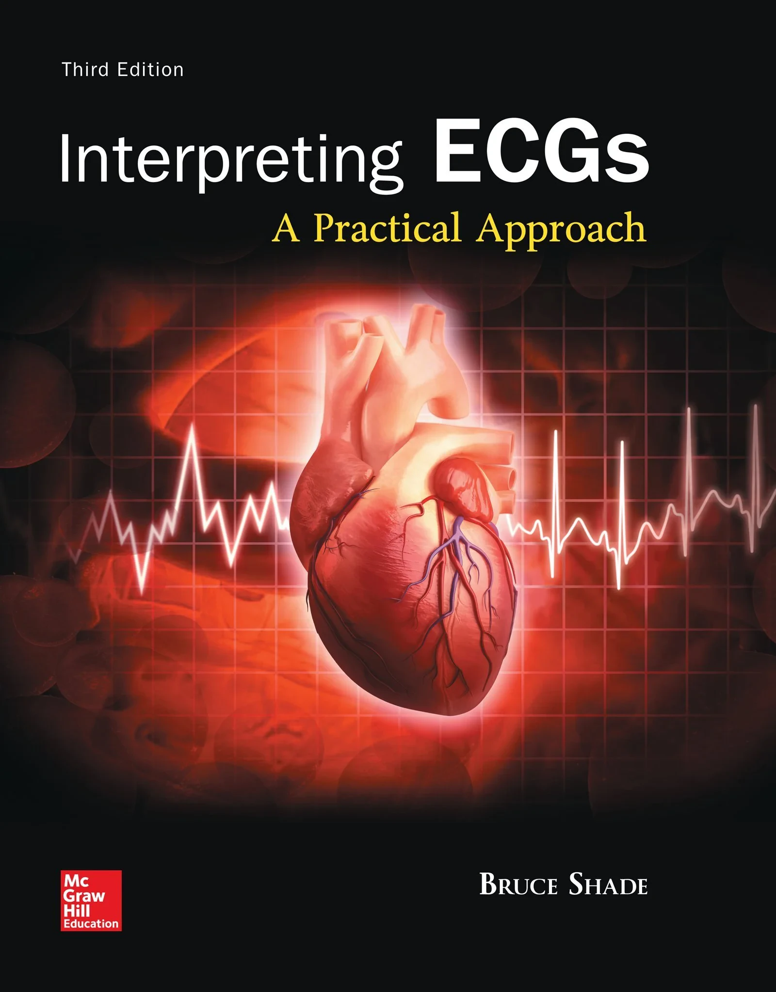 Coperta cărții "Interpreting ECGs: A Practical Approach" de autor necunoscut