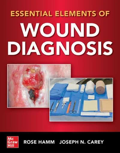 Coperta cărții "Essential Elements of Wound Diagnosis" de autor necunoscut
