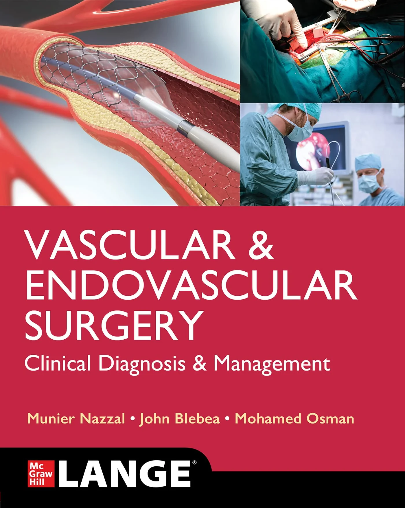 Coperta cărții "Vascular and Endovascular Surgery: Clinical Diagnosis and Management" de autor necunoscut