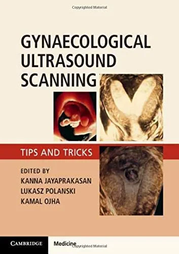 Coperta cărții "Gynaecological Ultrasound Scanning: Tips and Tricks" de autor necunoscut