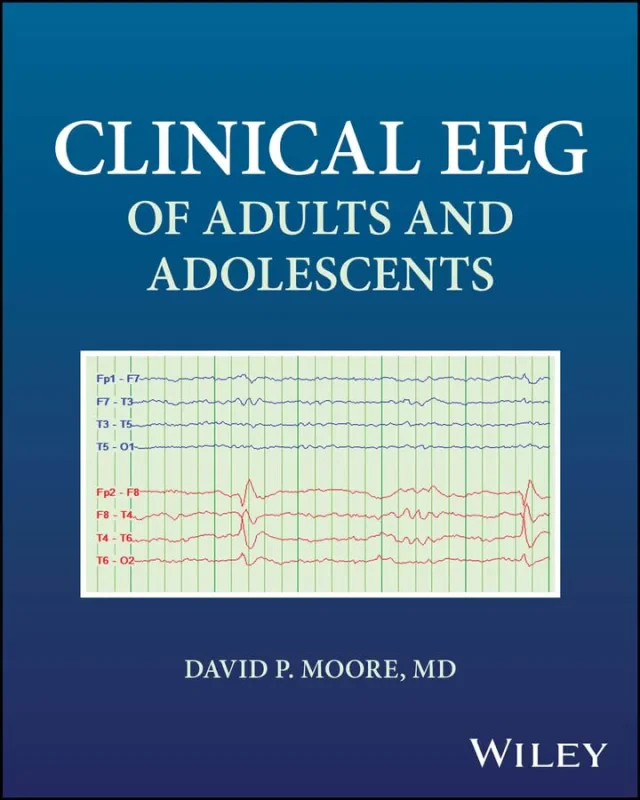 Coperta cărții "Clinical EEG of Adults and Adolescents 1st Edition" de autor necunoscut