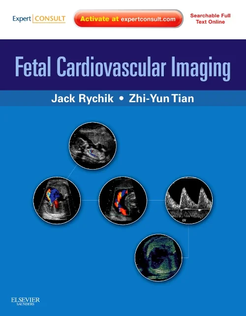 Fetal Cardiovascular Imaging: A Disease Based Appr...