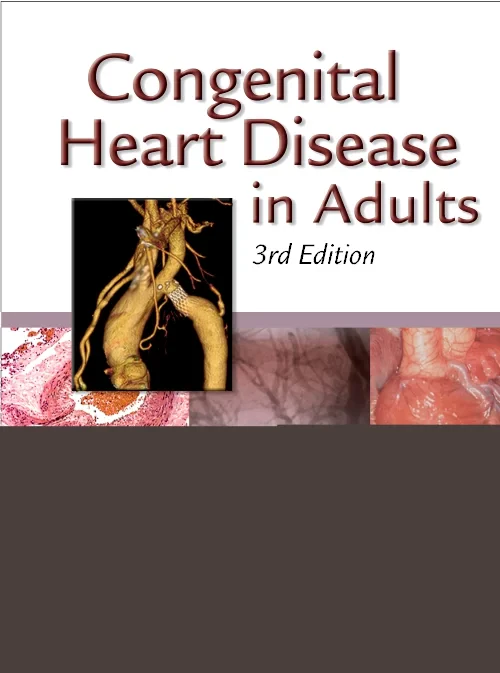 Congenital Heart Disease in Adults