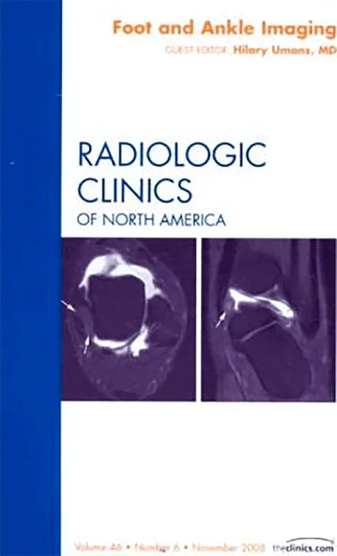 Foot and Ankle Imaging, An Issue of Radiologic Cli...