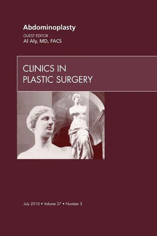 Abdominoplasty, An Issue of Clinics in Plastic Sur...