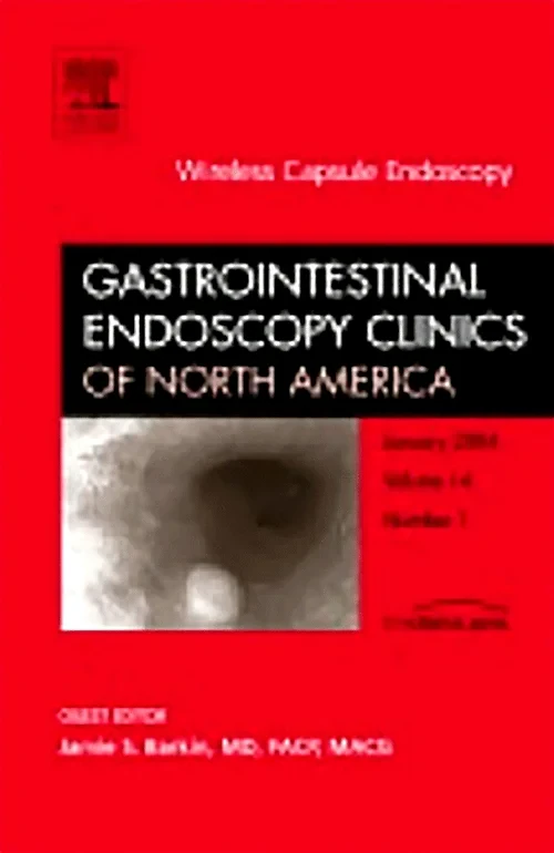 Quality Colonoscopy, An Issue of Gastrointestinal ...