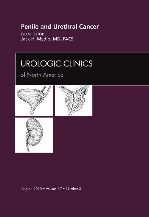 Penile and Urethral Cancer, An Issue of Urologic C...