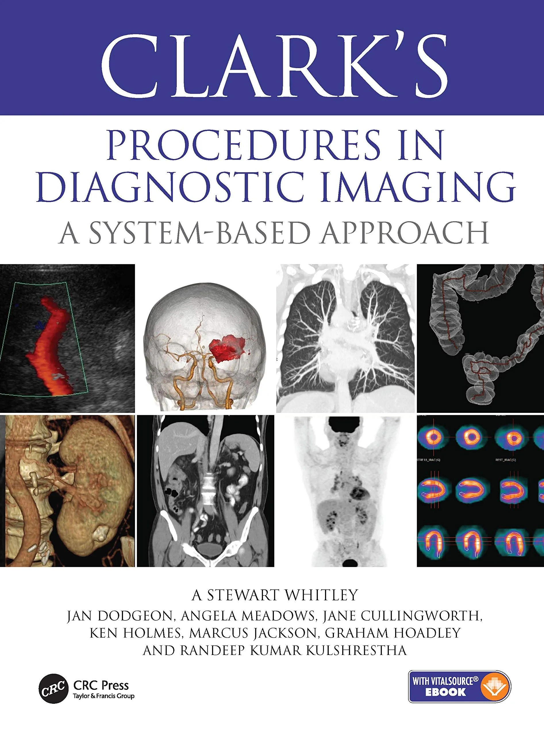 Coperta cărții "Clark&amp;#146;s Procedures in Diagnostic Imaging: A System-Based Approach" de autor necunoscut