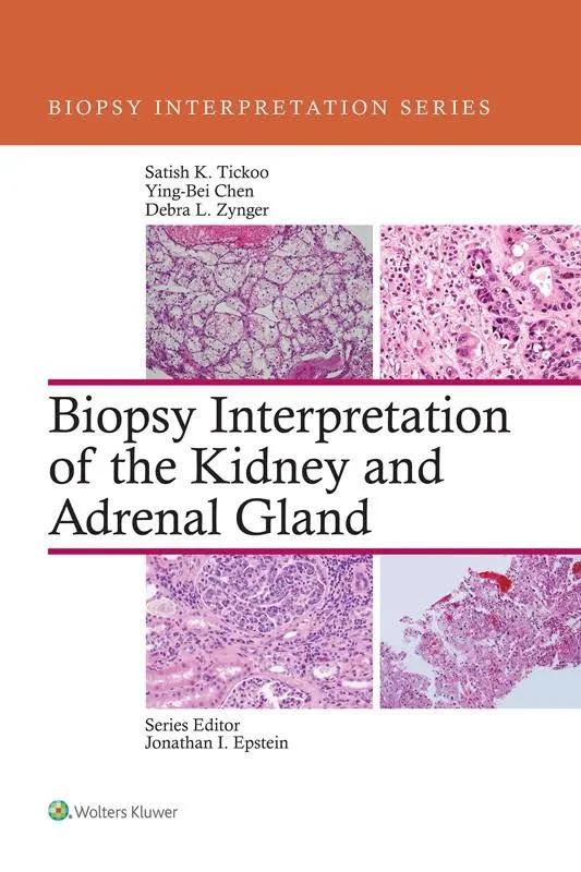 Coperta cărții "Biopsy Interpretation of the Kidney &amp; Adrenal Gland" de autor necunoscut