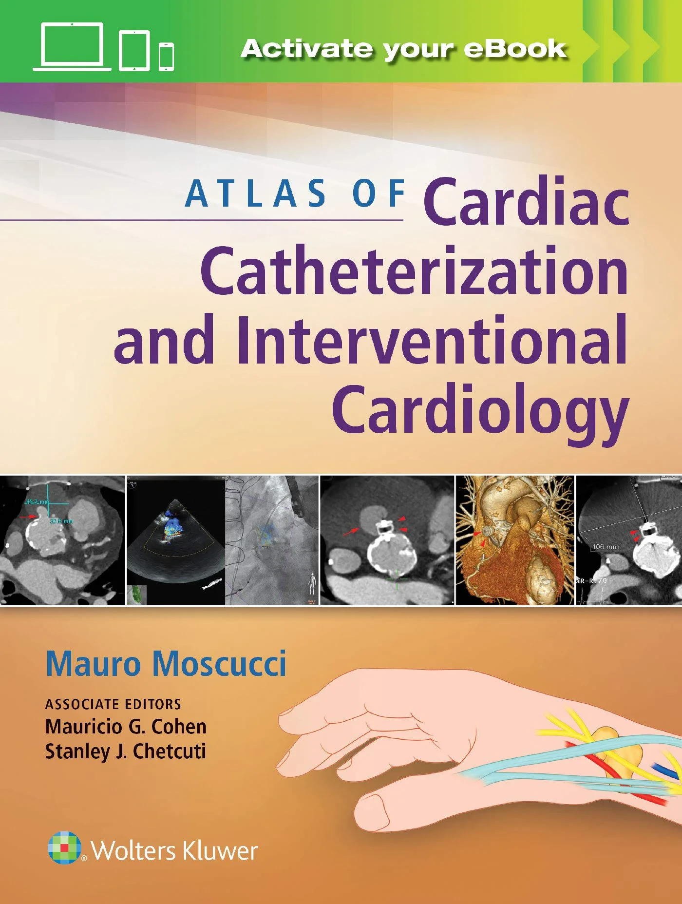 Coperta cărții "Atlas of Cardiac Catheterization and Interventional Cardiology: Practical Images for Diagnosis and Ablation" de autor necunoscut