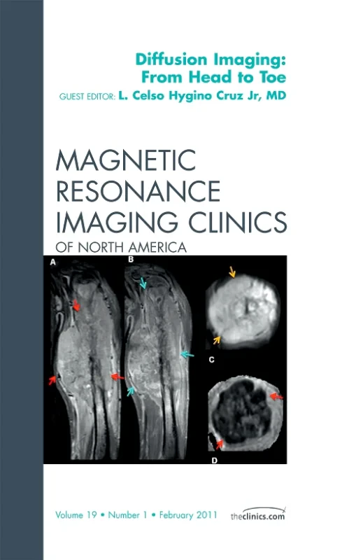 Clinical Applications of Diffusion Imaging: from H...