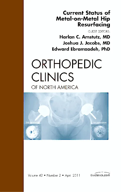 Current Status of Metal-on-Metal Hip Resurfacing, ...