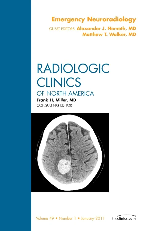 Emergency Neuroradiology, An Issue of Radiologic C...