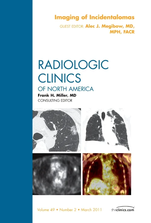 Imaging of Incidentalomas, An Issue of Radiologic ...