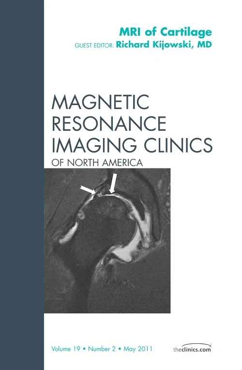 MRI of Cartilage, An Issue of Magnetic Resonance I...