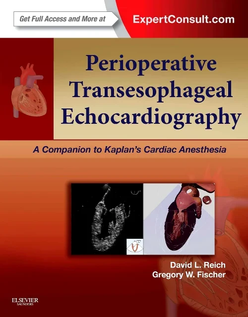 Perioperative Transesophageal Echocardiography