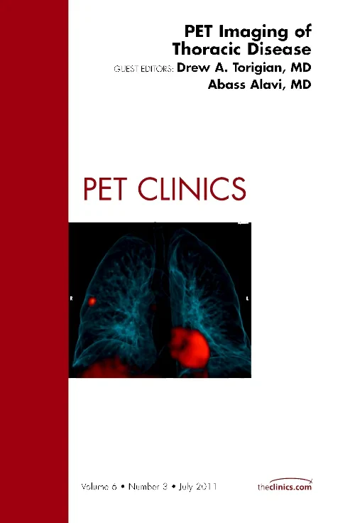 PET Imaging of Thoracic Disease, An Issue of PET C...