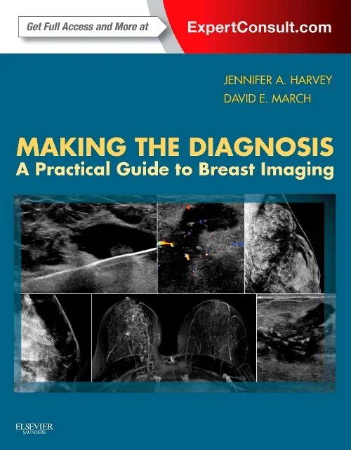 Making the Diagnosis: A Practical Guide to Breast ...