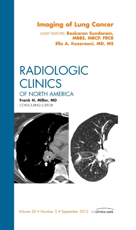 Imaging of Lung Cancer, An Issue of Radiologic Cli...