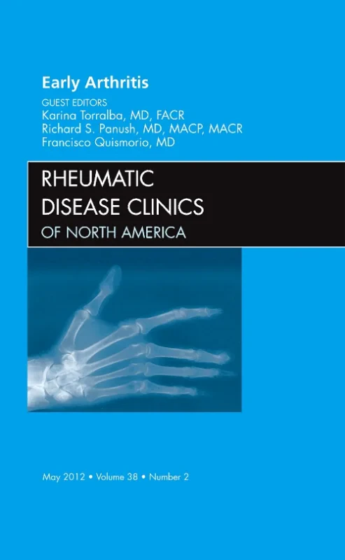 Early Arthritis, An Issue of Rheumatic Disease Cli...