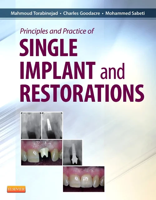 Principles and Practice of Single Implant and Rest...