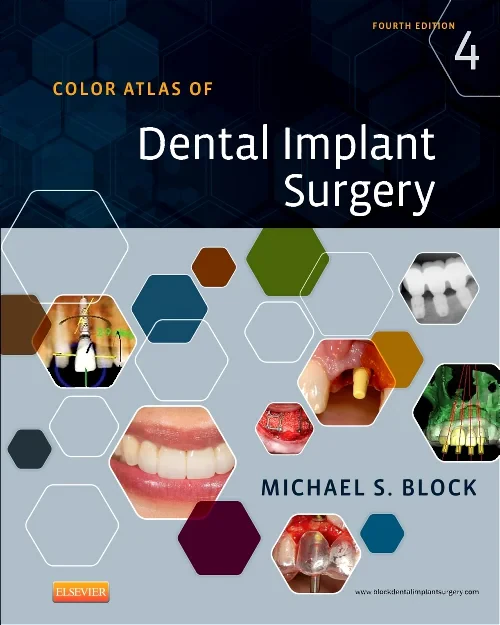 Color Atlas of Dental Implant Surgery