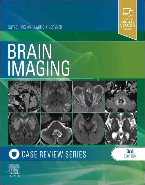 Brain Imaging