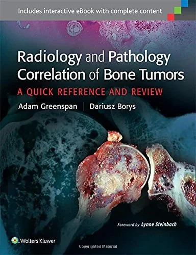 Coperta cărții "Radiology and Pathology Correlation of Bone Tumors" de autor necunoscut
