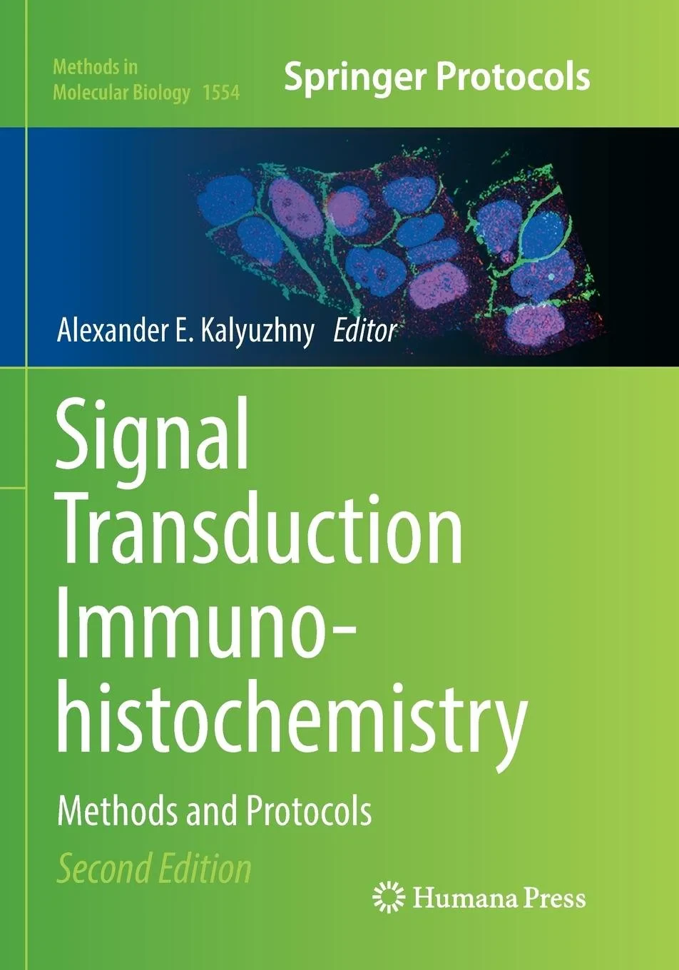 Coperta cărții "Signal Transduction Immunohistochemistry: Methods and Protocols" de autor necunoscut